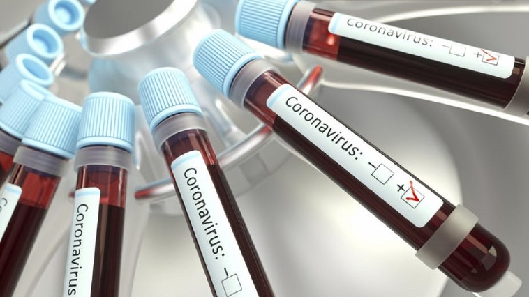 Coronavirus in Romania, 31 Iulie! Autoritatile au transmis cifrele momentului