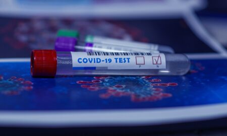 Vești bune! Testele rapid antigen pentru COVID au ajuns acum și în România. Rezultatul în 15 minute