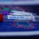 Vești bune! Testele rapid antigen pentru COVID au ajuns acum și în România. Rezultatul în 15 minute