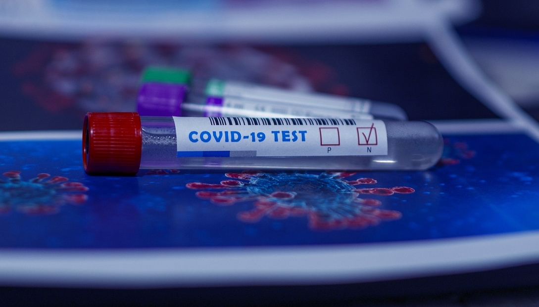 Vești bune! Testele rapid antigen pentru COVID au ajuns acum și în România. Rezultatul în 15 minute