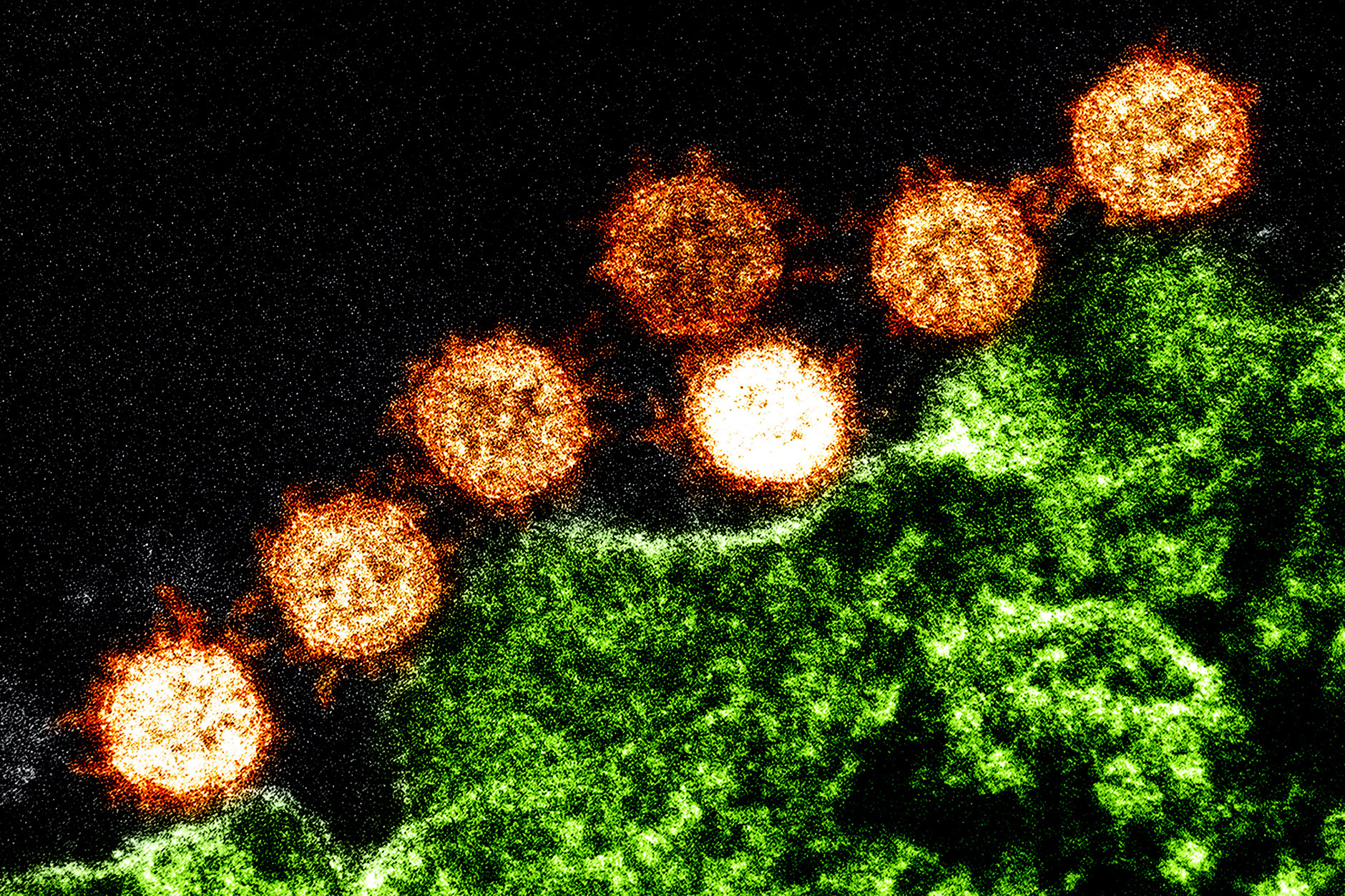 Bilanț COVID-19 din 13 iulie 2021. Evoluția infectărilor cu coronavirus