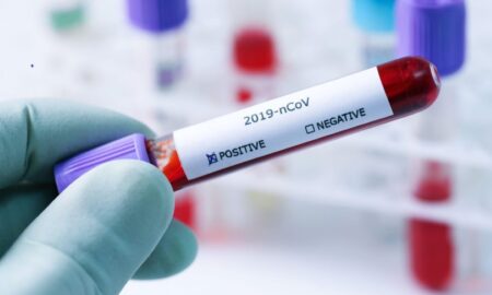 Coronavirus în România, 2 Decembrie! Au fost raportate cifrele negre ale zilei