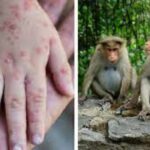 Noua boală, „variola maimuței”, se extinde în Europa. În două țări s-a declanșat alerta națională