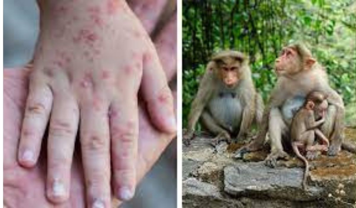 Vrei să știi cum să te păzești de Variola maimuței, cum se transmite boala și dacă există vaccin? Citește aici răspunsurile