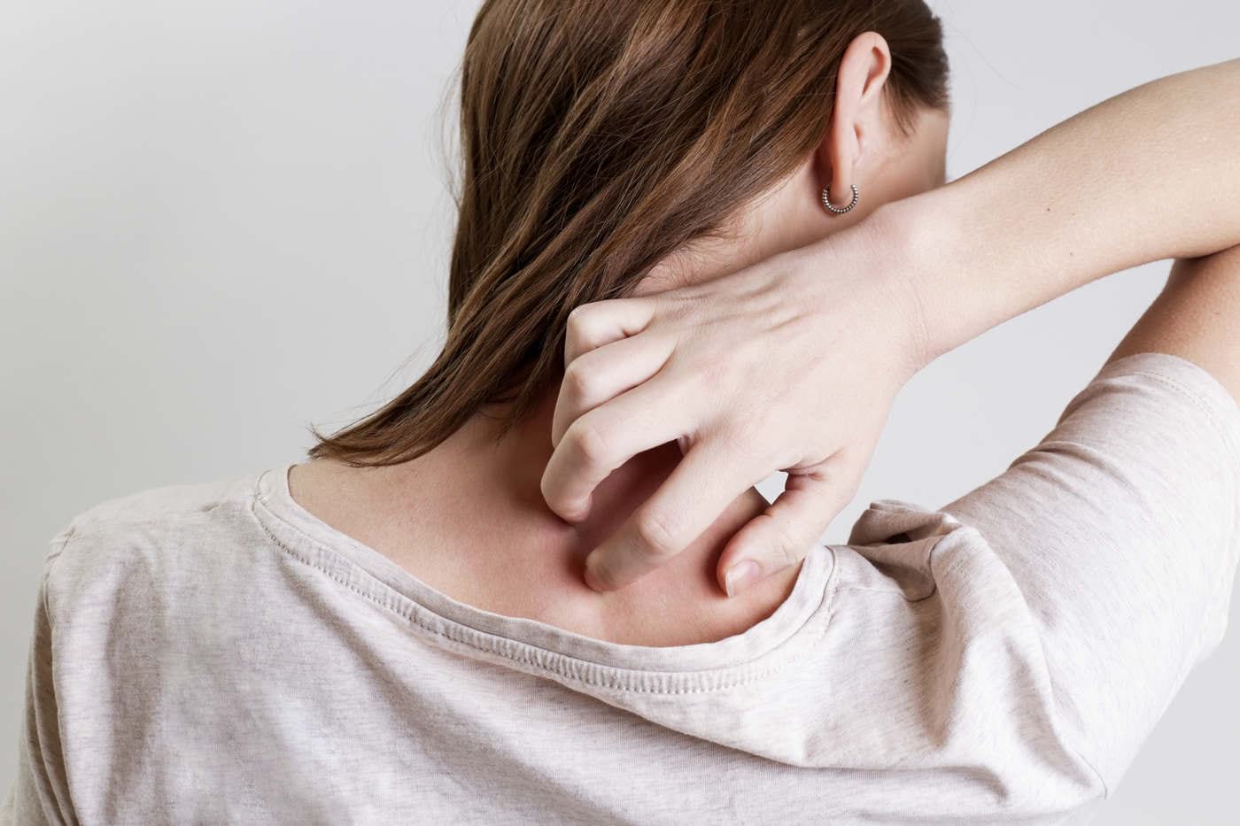 Pacienții cu psoriazis, dermatită atopică și urticarie, tratați gratuit
