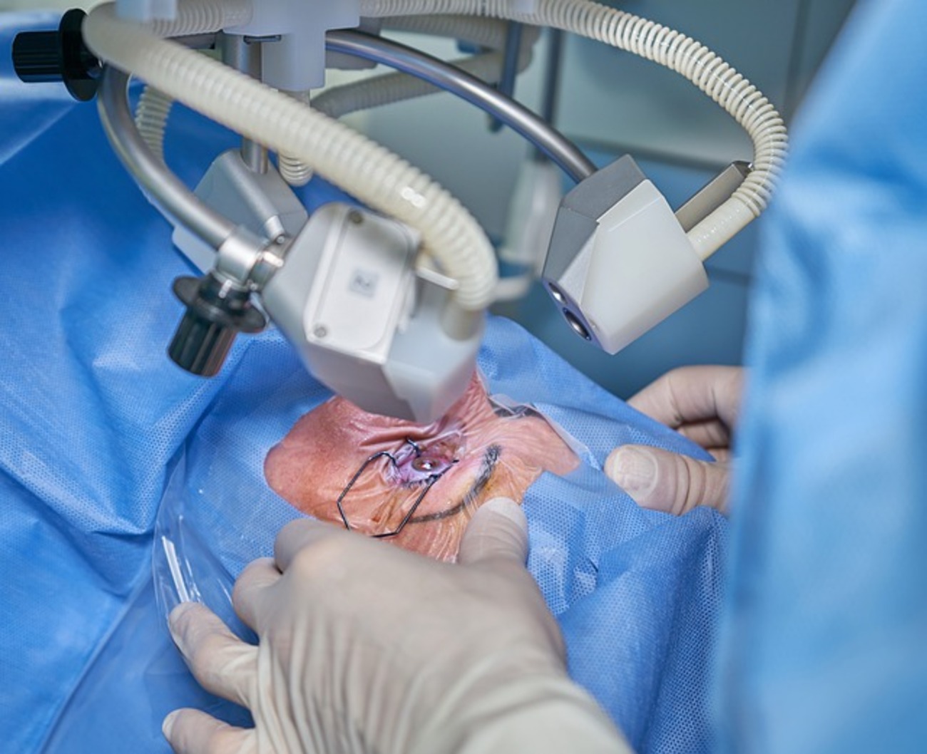 Caz halucinant. A plecat cu gândul să vadă, dar a rămas orb. Medicul i-a operat ochiul sănătos. Motivul e mai uluitor
