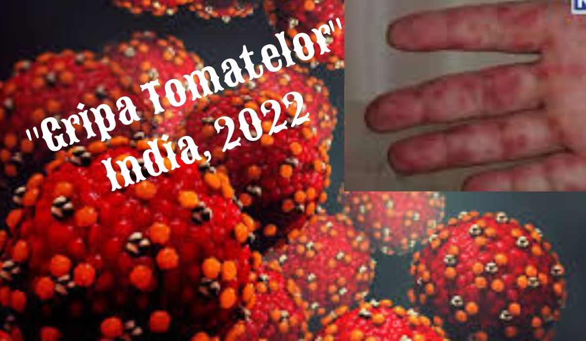 „Gripa tomatelor”, depistată inițial la copiii din sudul Indiei, acum s-a răspândit și în est