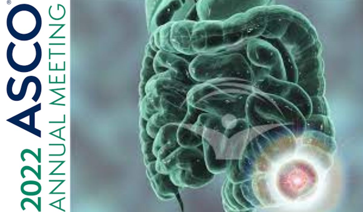 Pacienţii cu cancer de colon inoperabil pot spera la încă o șansă