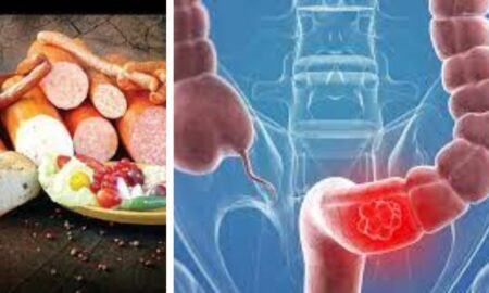 Otrava din alimente care crește riscul de cancer colorectal. Deja se iau măsuri