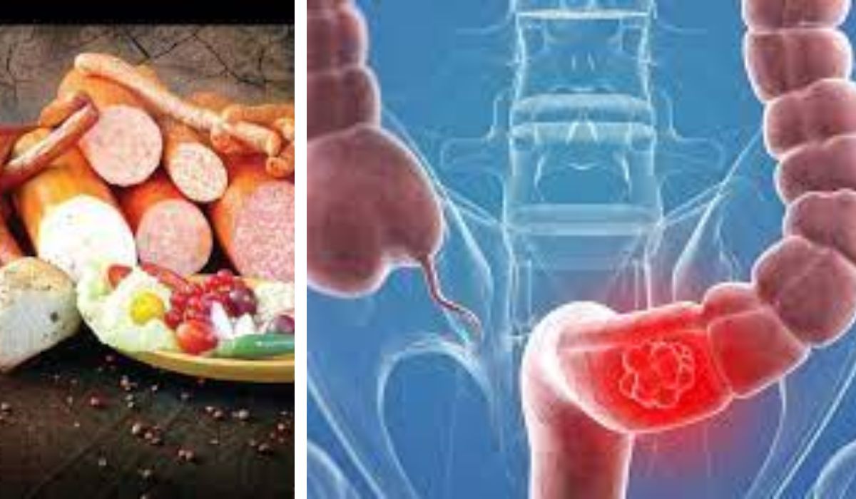 Otrava din alimente care crește riscul de cancer colorectal. Deja se iau măsuri
