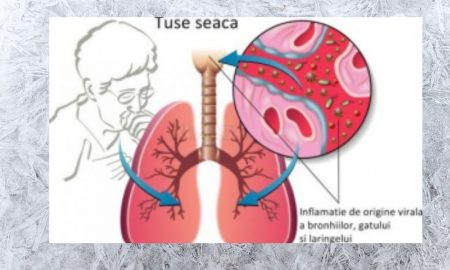 Totul despre tusea seacă și cum poate fi tratată în mod natural