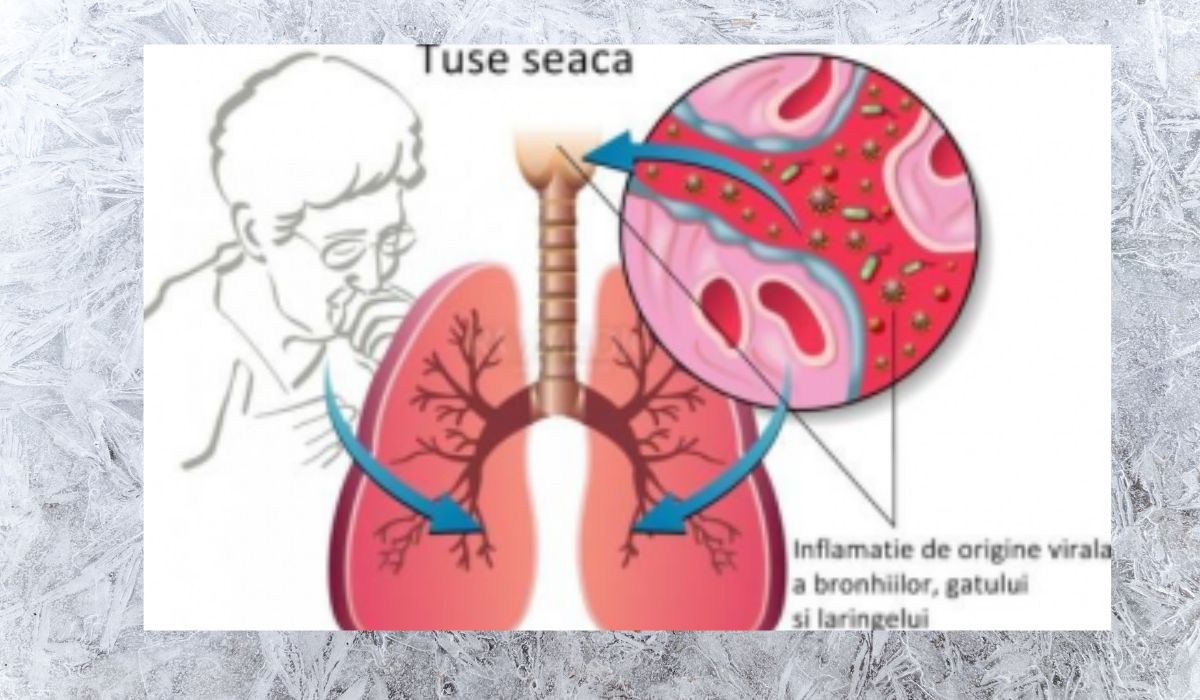 Totul despre tusea seacă și cum poate fi tratată în mod natural