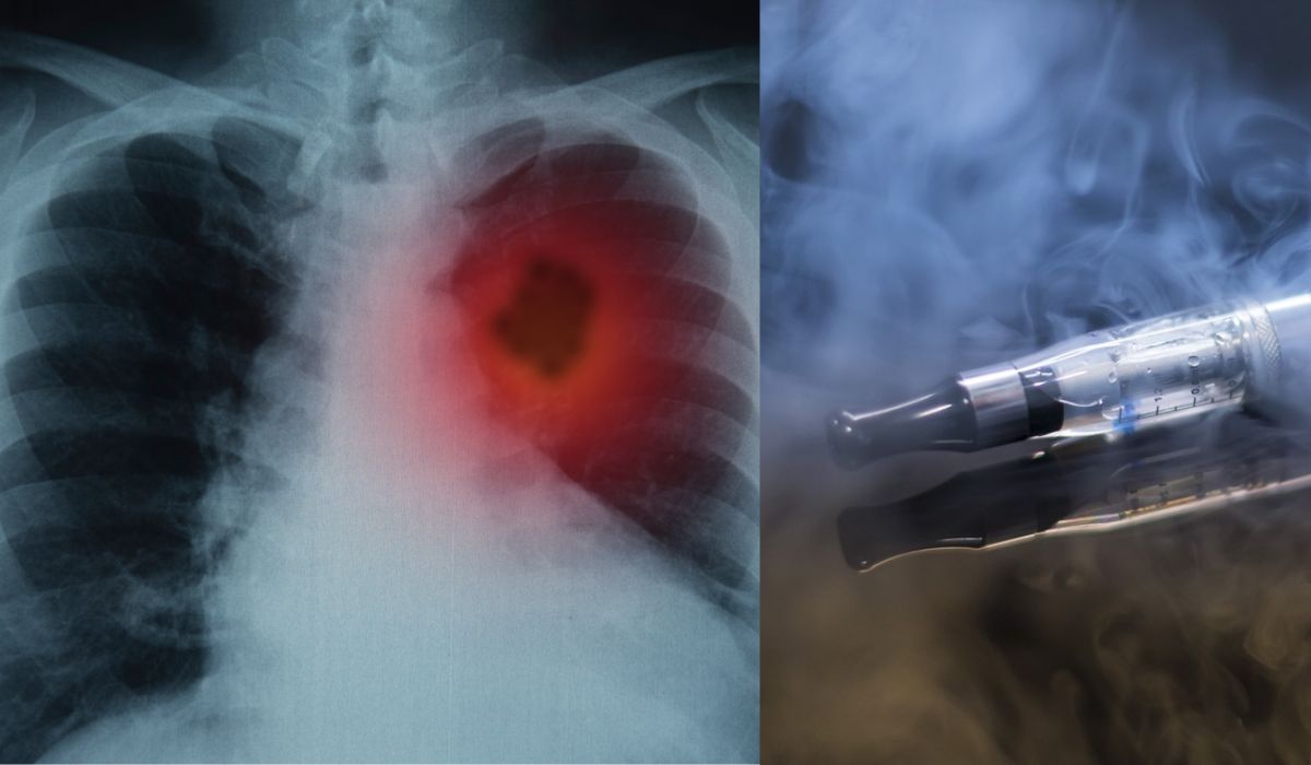 Dispozitivele electronice și tutunul încălzit produc leziuni pulmonare similare celor produse de COVID