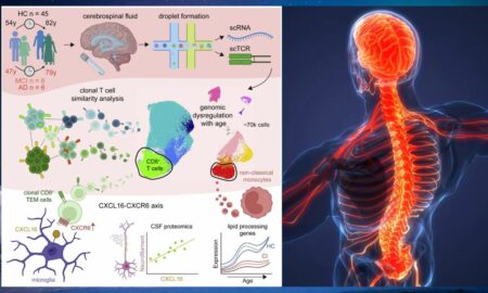 Cercetătorii au făcut o nouă descoperire care arată o cauză potențială a bolii Alzheimer