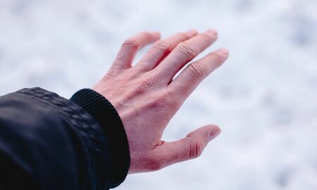 Vremea aspră de iarnă atacă pielea. Cele mai bune trucuri pentru a vă proteja de frig.  Încercați și veți vedea diferența